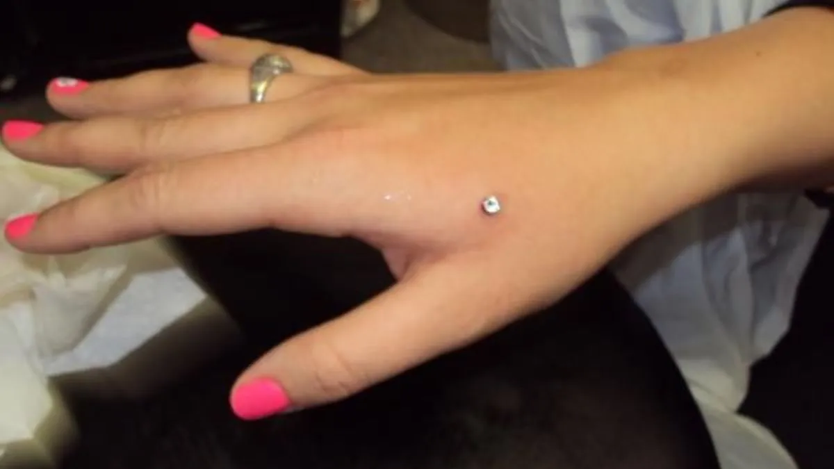 Dermal Finger Piercing